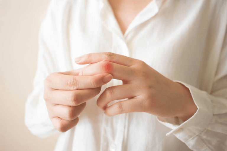 Understanding Systemic Sclerosis: Symptoms, Causes, and Treatments