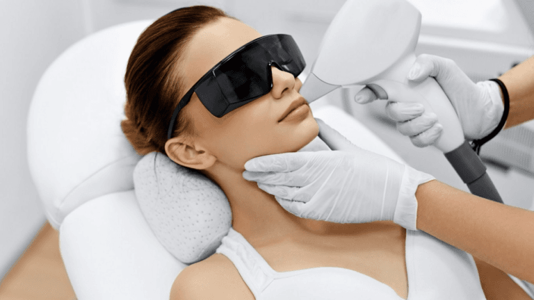 Fractional CO2 Laser and Radiofrequency