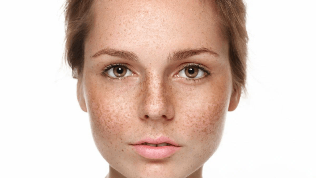 Una persona joven con tono de piel claro, cabello castaño y pecas que mira directamente a la cámara con una expresión neutra.