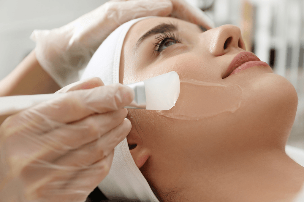 Was ist das beste Mittel zum Entfernen von Melasma?