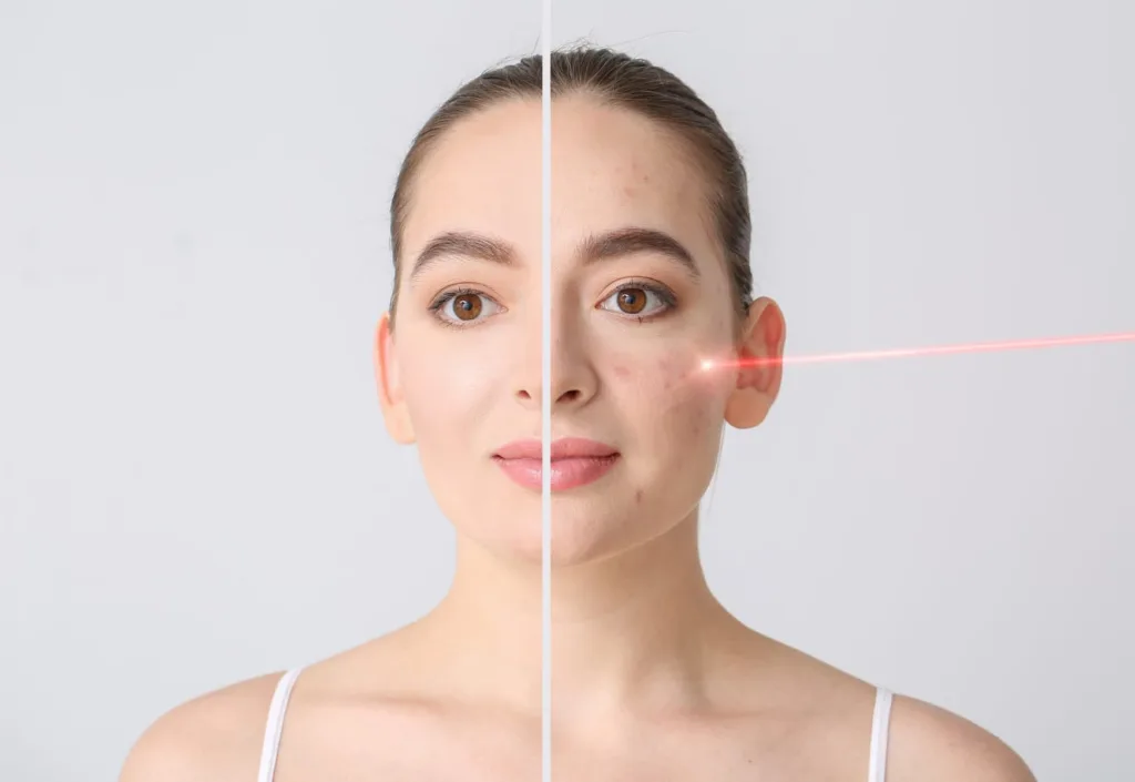 ¿El láser facial tiene efectos secundarios?