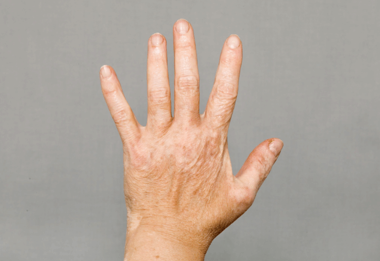 An image of a hand with visible veins and wrinkles against a plain background.